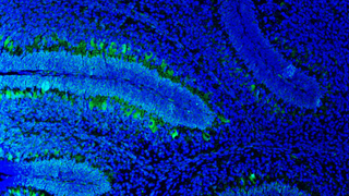 Nanotechnologies for Neurosciences