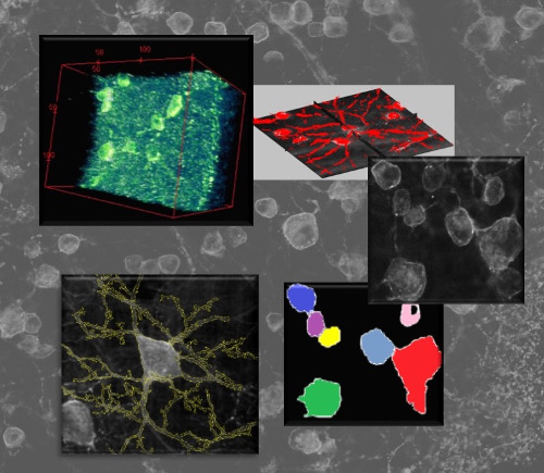 Processing used to determine morphology of retinal ganglion cells