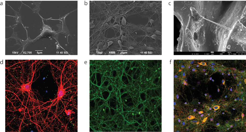 Scanning Electron Microscopy (a, b, c) and Fluorescence Confocal (d, e, f) images of primary neurons: (i) exposed to graphene nanosheets, (ii) grown onto CVD graphene substrates and (iii) 3D scaffolds.